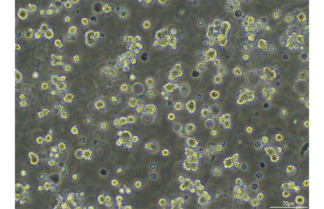 浮遊培養中の完全養殖クロマグロの細胞